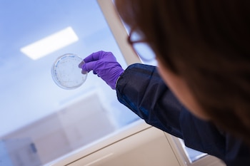 Muestra de un cultivo de