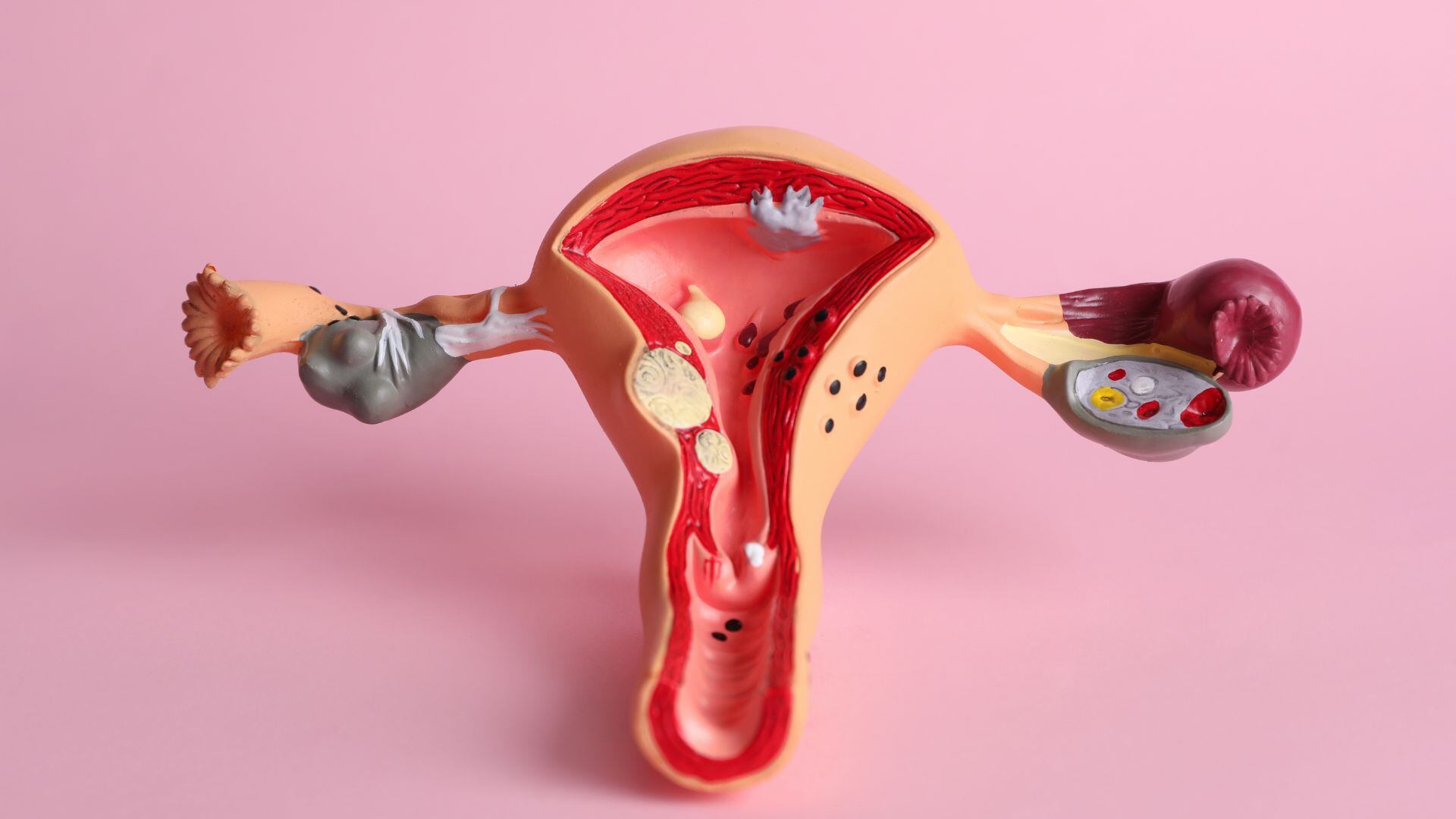 Ilustración del órgano reproductor femenino, en el que se encuentra la vagina. (Canva)