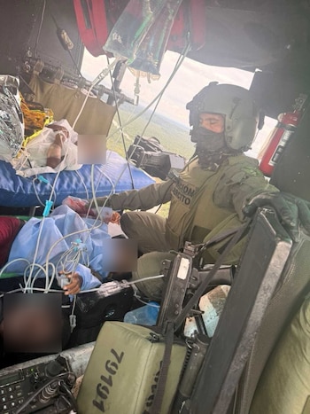 Cuatro menores resultaron gravemente heridos tras la activación de un campo minado en la vereda La Laguna, Nariño - crédito Suministrado a Infobae Colombia