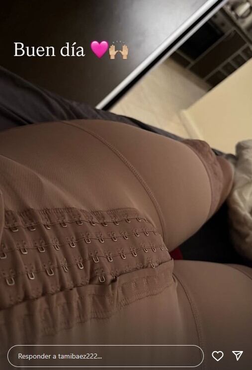 Tamara Báez compartió la recuperación de su cirugía estética (Instagram)