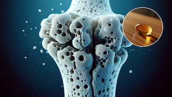 No es la falta de calcio: el verdadero nutriente del que carecen las mujeres y que causa la aparición de osteoporosis