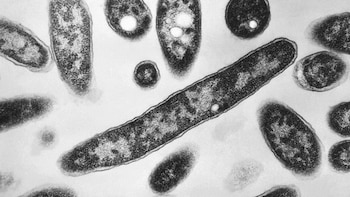 ¿Qué es la enfermedad del legionario? La infección bacteriana que puso en alerta a una ciudad de Estados Unidos