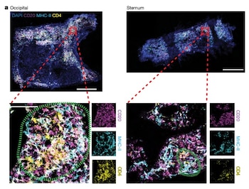 Cuatro imágenes de microscopía muestran la distribución de marcadores celulares DAPI, CD20, MHC-II y CD4 en dos secciones de tejido con leyendas y escalas