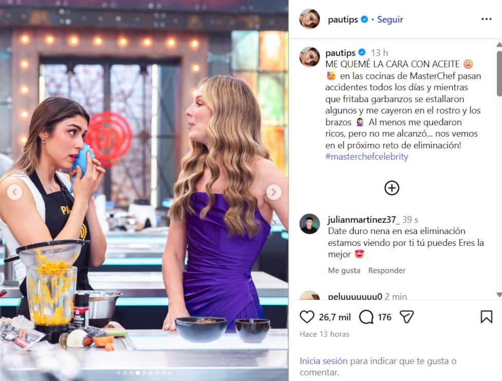 La creadora de contenido se puso hielo en la cara para aliviar el ardor por las quemaduras - crédito @pautips/IG