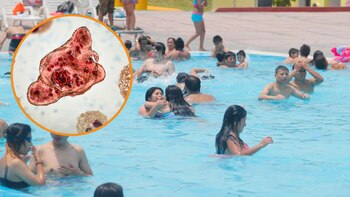 Una piscina de Canta en malas condiciones higiénicas causó que un adolescente quede al borde de la muerta al contraer una ameba en el cerebro | Foto referencial