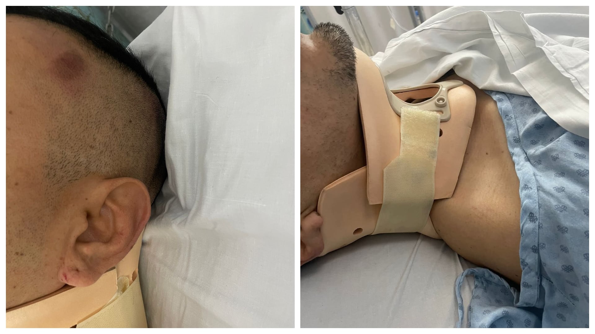 El reportero fue agredido mientras hacía una transmisión en directo. (Crédito: X)