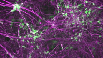 Pacientes con ELA: la reprogramación