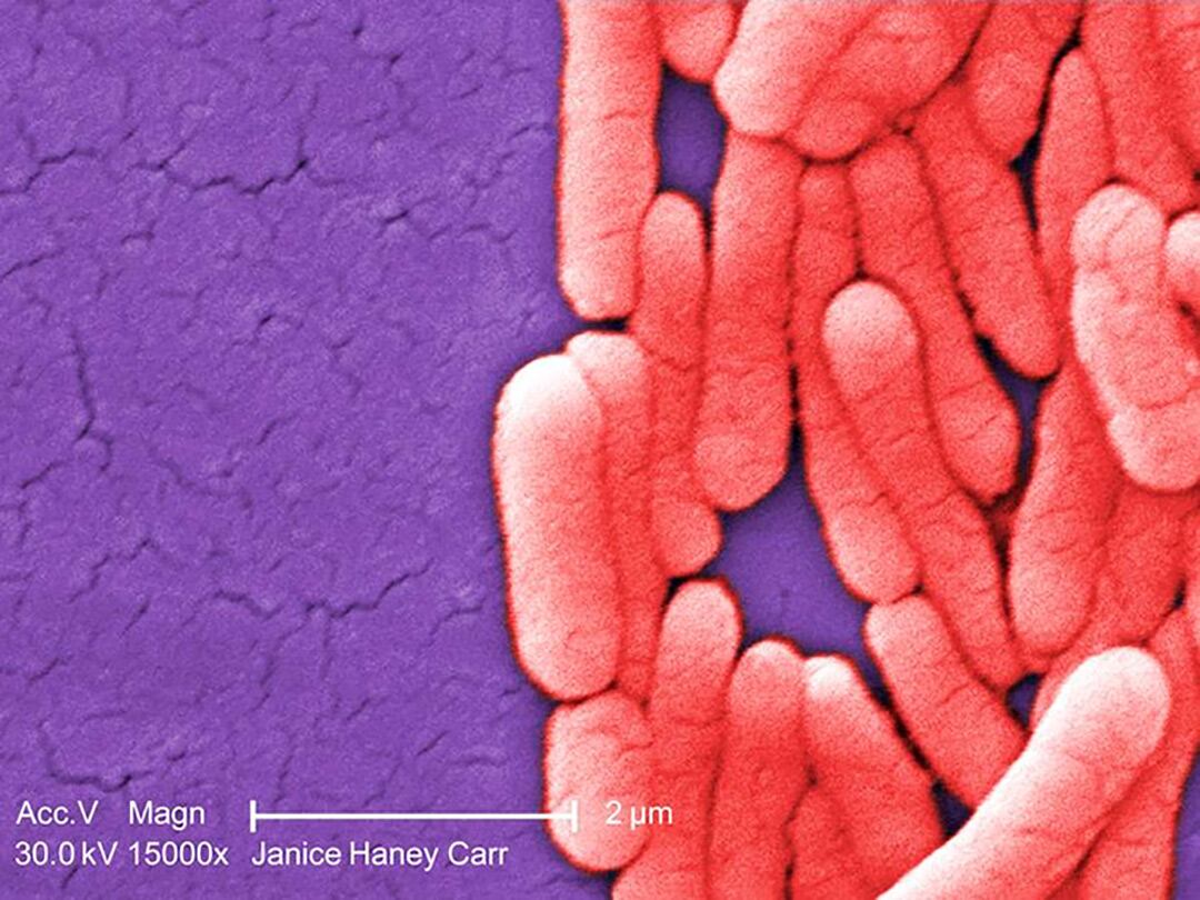 (U.S. Centers for Disease Control and Prevention)