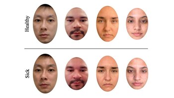 Ejemplo de rostros sanos y