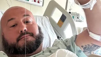 Es pescador, lo mordió un tiburón en Florida y casi le quita el pie: “Me di cuenta de que cada minuto cuenta en la vida”
