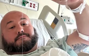 Un hombre con barba y la cabeza rapada yace en una cama de hospital con una bata médica y una pulsera de identificación