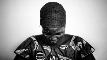 La cartera sanitaria argentina señaló,