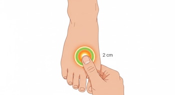 Ilustración de pie humano con pulgar presionando entre primer y segundo dedo. Un círculo luminoso naranja y verde marca la zona. Se lee "2 cm".