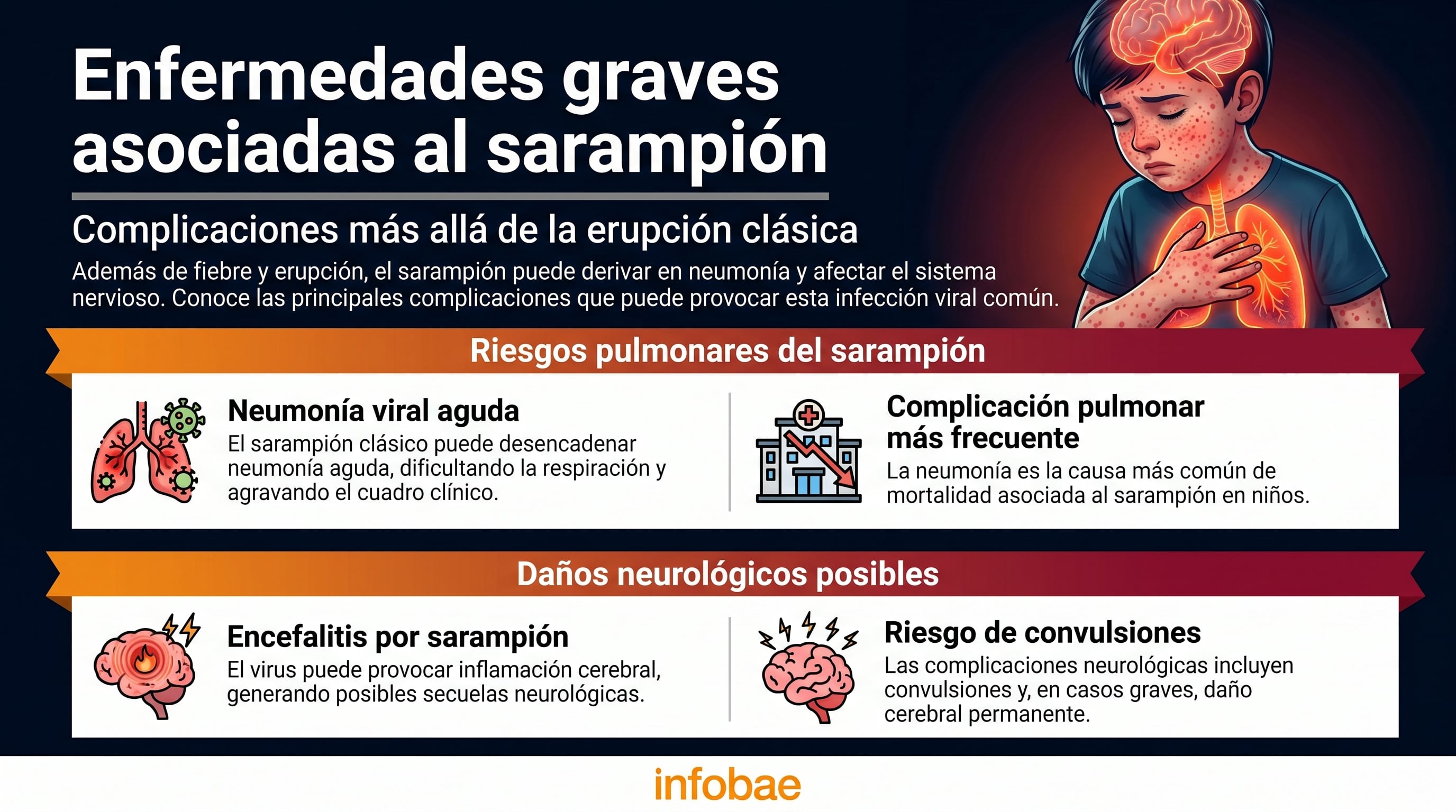 Infografía detalla las graves complicaciones pulmonares y neurológicas asociadas al sarampión clásico, incluyendo neumonía, encefalitis y convulsiones. (Imagen Ilustrativa Infobae)
