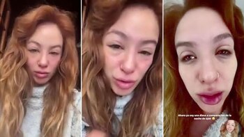 Flor Vigna preocupó a sus