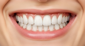 Primer plano de una boca abierta con dientes blancos y rectos y encías rosadas; los labios están ligeramente separados mostrando una sonrisa.