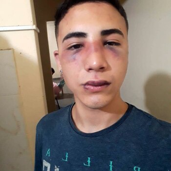 Así quedó Ezequiel tras ser