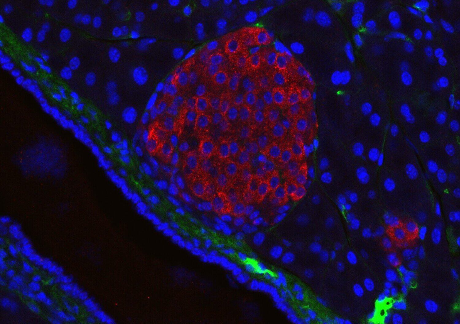 Producción de insulina en el cuerpo Islote Langerhans. (Foto de : Jakob Suckale cc by-sa 3.0 - Karolinska Institute)