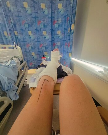 Katie Archibald mostró cómo quedó