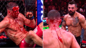 La sangrienta pelea entre dos figuras de MMA que terminó por una decisión médica: “No podía ver nada”