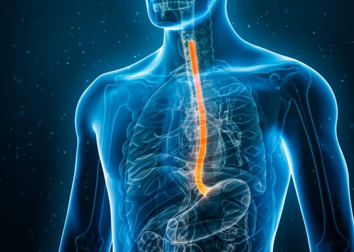 El reflujo ácido puede ser síntoma de cáncer de esófago, por lo que se recomienda atención médica ante señales de alerta (Imagen Ilustrativa Infobae)