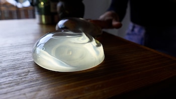 Informe - Adios Implantes