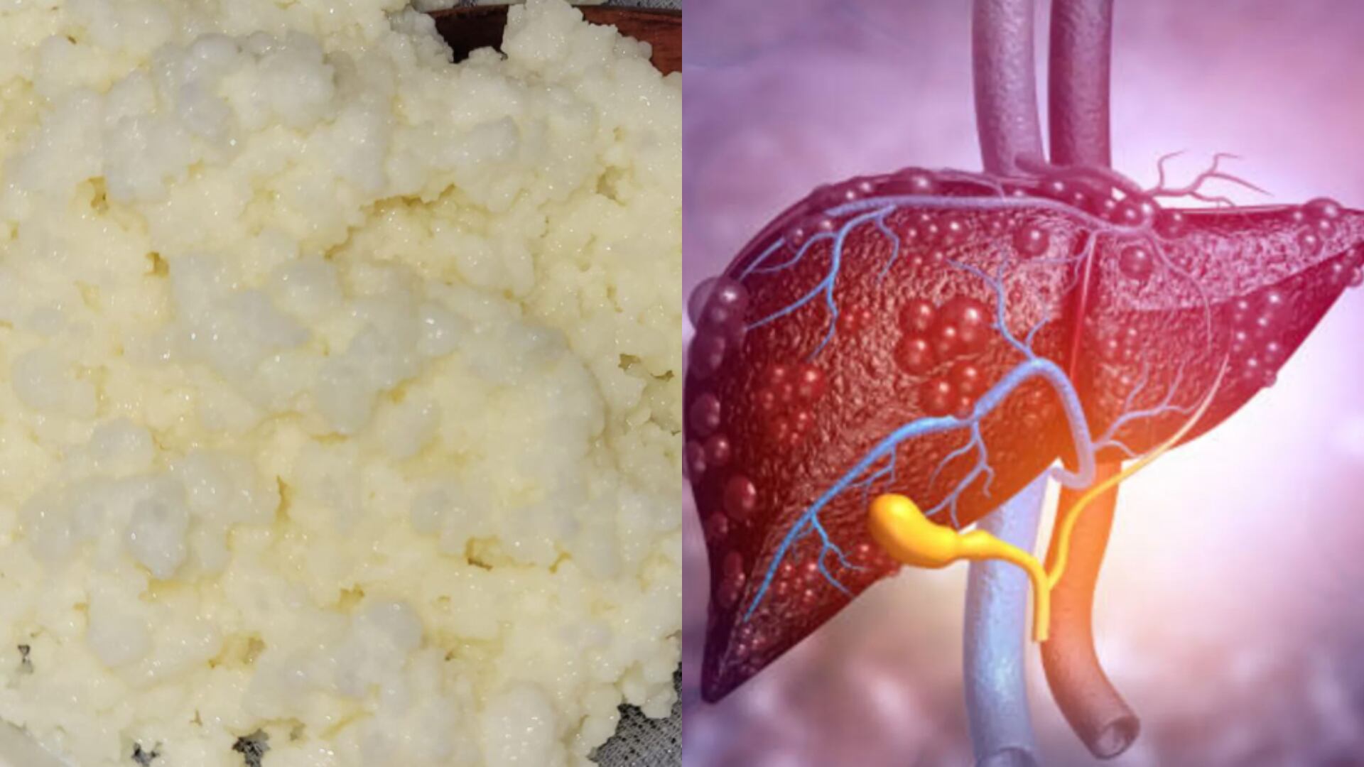 Los probióticos presentes en los búlgaros favorecen la desinflamación del hígado. (Imagen Ilustrativa Infobae)