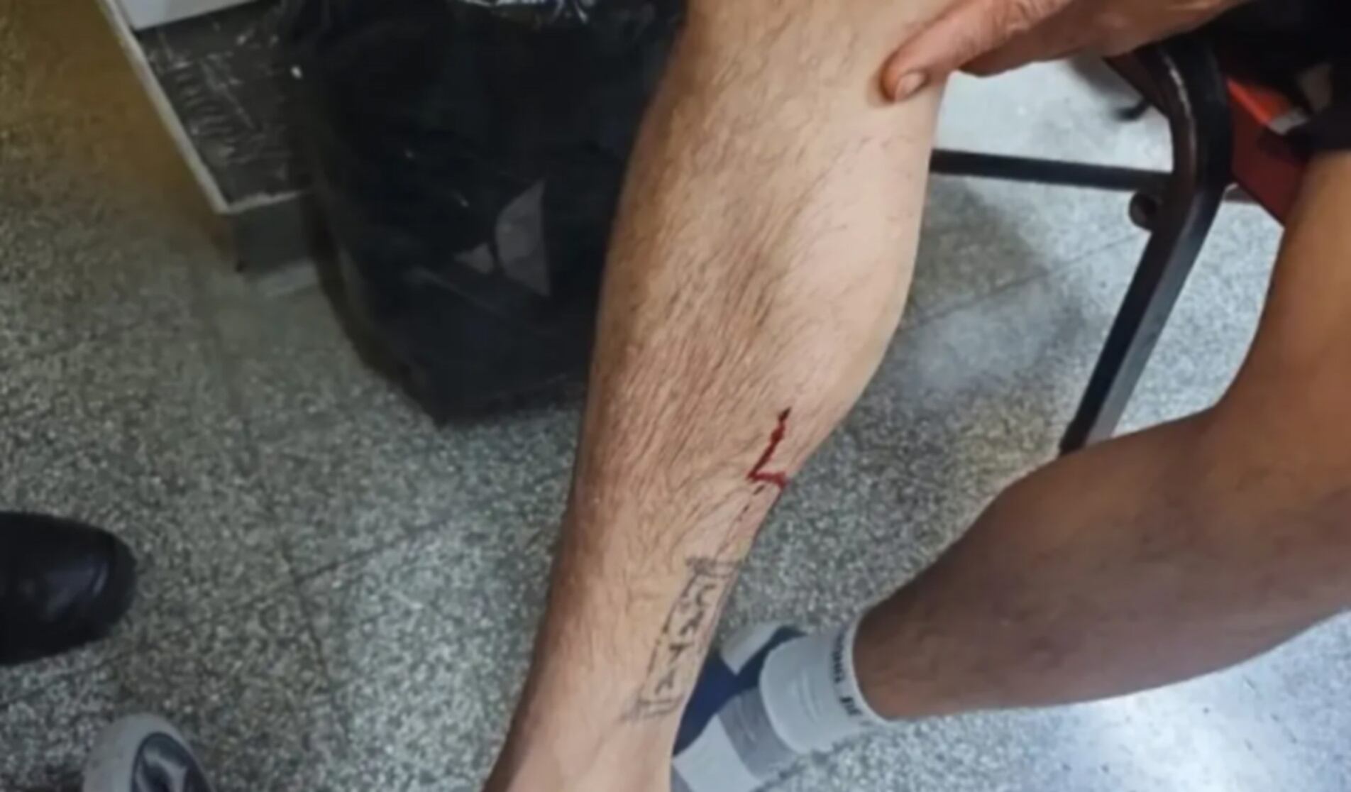 La víctima muestra la herida luego que dos delincuentes intentaran robarle la moto en La Plata y dispararle aunque no opuso resistencia (0221)