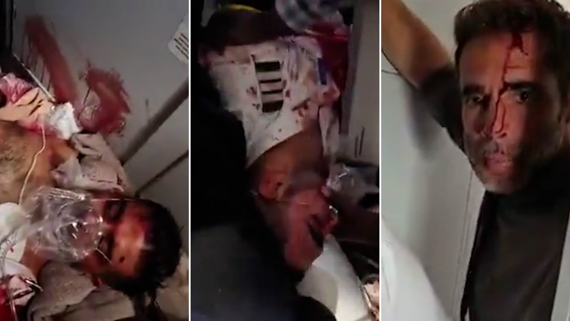 Tres fotogramas de un video registran a un hombre herido con manchas de sangre en el rostro mientras recibe atención médica y permanece de pie.
