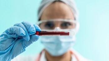 “Vamos a sacar una terapia