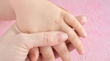 ¿Qué precauciones adicionales se deben