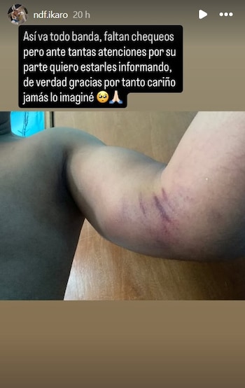 Íkaro aseguro que la evolución