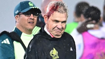 Federación de Honduras señaló a