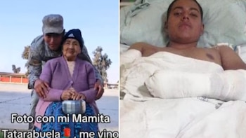 Amputan brazo a soldado que