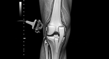 Pierna humana, rodilla, transductor de ultrasonido, imagen ecográfica de tejidos internos, escala de profundidad.