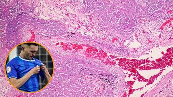 Qué es y cómo saber