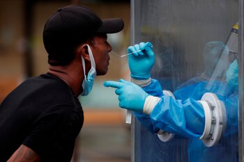 Un hombre se somete a