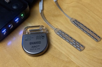 Este es el neuroestimulador ARC