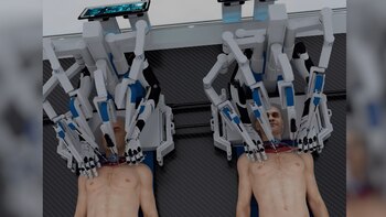 Así se vería un trasplante