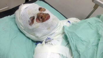 Mujer calentó aceite, esperó a