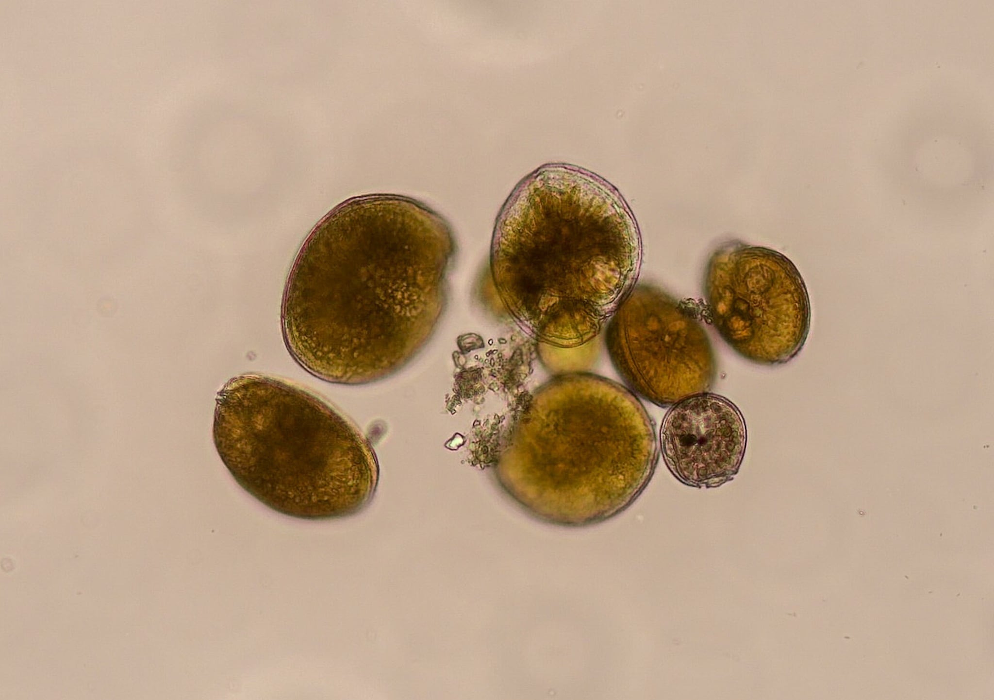 Científicos identificaron por primera vez Gambierdiscus australes en Cuba a partir de muestras recolectadas en el litoral de La Habana. (Antonio b. Yanguas / Universidad de Alicante)