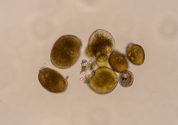 'Gambierdiscus australes' en microscopio óptico