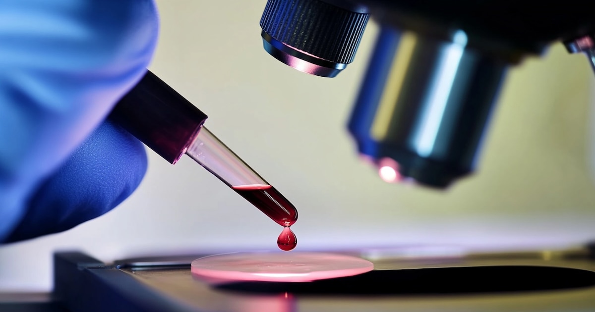 Alzheimer: La Sangre Revela Secretos Ocultos