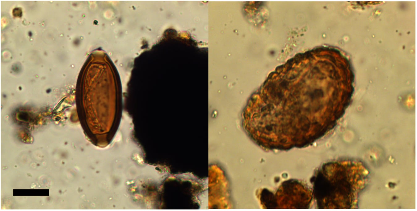 Huevos de Trichuris sp. (izquierda) y Ascaris sp. (derecha) hallados en Vindolanda. La barra de escala mide 20 µm (Universidad Cambridge)