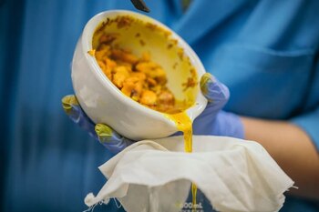 La tecnología convierte el excedente