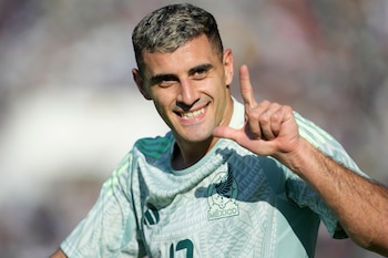 (AP Foto/Juan Karita)