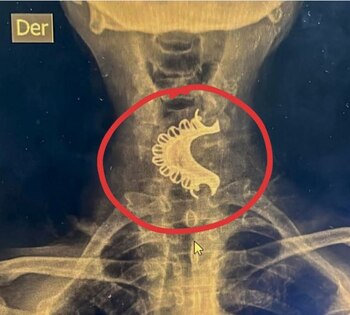 El adulto mayor ya fue