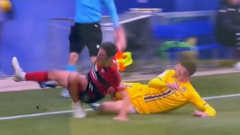 La espeluznante fractura de un