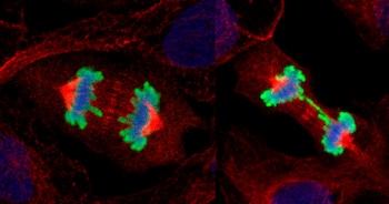 Comparación entre células sanas en