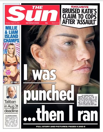 La exmodelo fue golpeada directamente